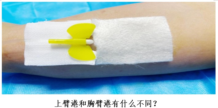 Snipaste_2024-07-02_08-13-30.jpg Snipaste_2024-07-02_08-13-30.jpg