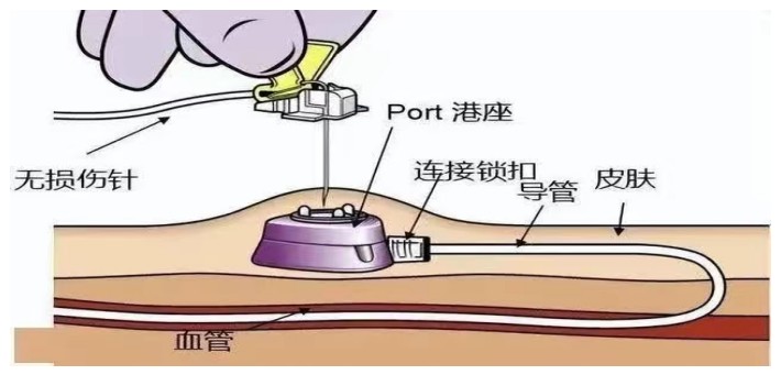 Snipaste_2024-07-02_08-13-09.jpg Snipaste_2024-07-02_08-13-09.jpg