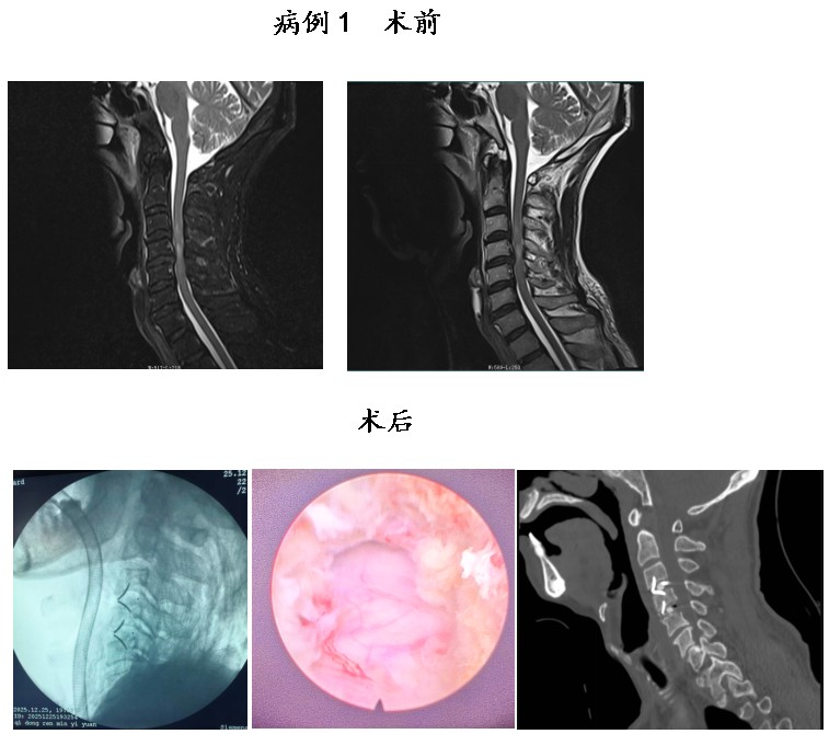 Snipaste_2026-03-12_10-33-13.jpg Snipaste_2026-03-12_10-33-13.jpg