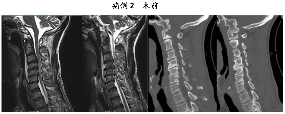 Snipaste_2026-03-12_10-34-24.jpg Snipaste_2026-03-12_10-34-24.jpg