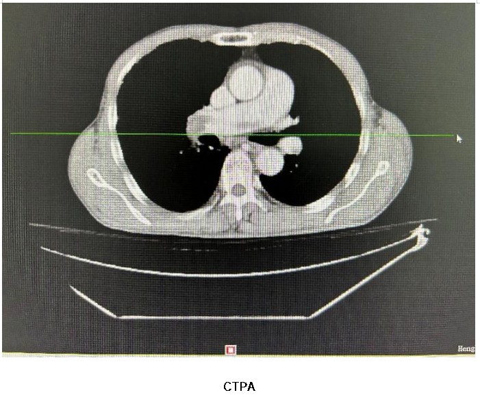 Snipaste_2026-03-18_10-04-07.jpg Snipaste_2026-03-18_10-04-07.jpg